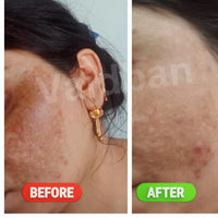 Vaidban Rupanjali AM Oil - 10 ml - Nourishing Day Oil with Ayurvedic Ingredients for Skin Radiance thumbnail 2