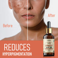 Vaidban Apricot Oil (30Ml) – Your Secret to Brighter, Healthier Skin thumbnail 1